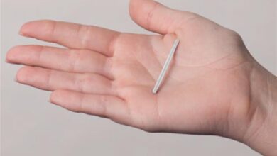 مزايا وسلبيات شريحة منع الحمل للنساء