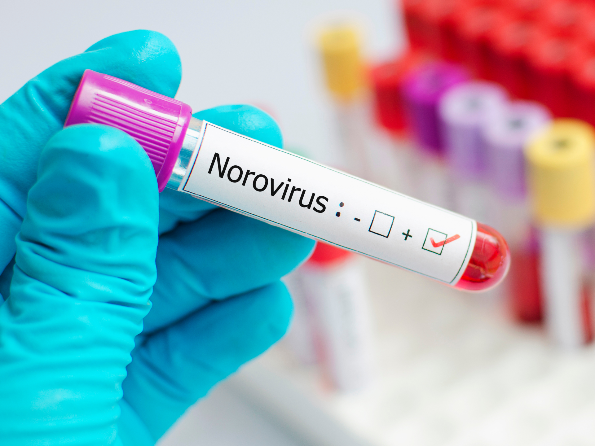 ماهو norovirus الفيروس الجديد في اوروبا